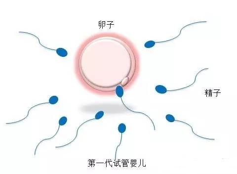 私人志愿者供卵助孕包生儿子